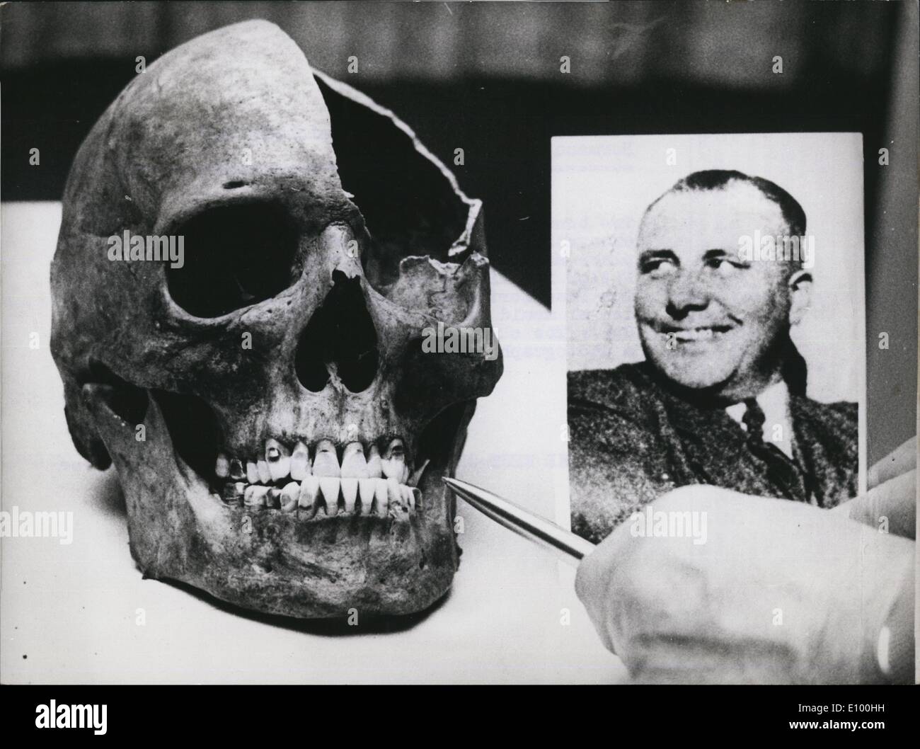 Febbraio 02, 1972 - Nuova traccia in caso di ''Reichsleiter'' Bormann marziano?: due ossa di un teschio e coscia sono stati trovati negli scavi in Berlino, stazione di Livorno,. In questo luogo Martin Bormann, la "sostituire"' di Adolf Hitler è detto di essere ucciso il suo volo 1945.La Francoforte ufficio del procuratore generale ha inviato il stampo dentale del leader nazista a Berlino. La foto mostra il cranio con ben conservati i denti e una fotografia del ''Reichslioter' Foto Stock
