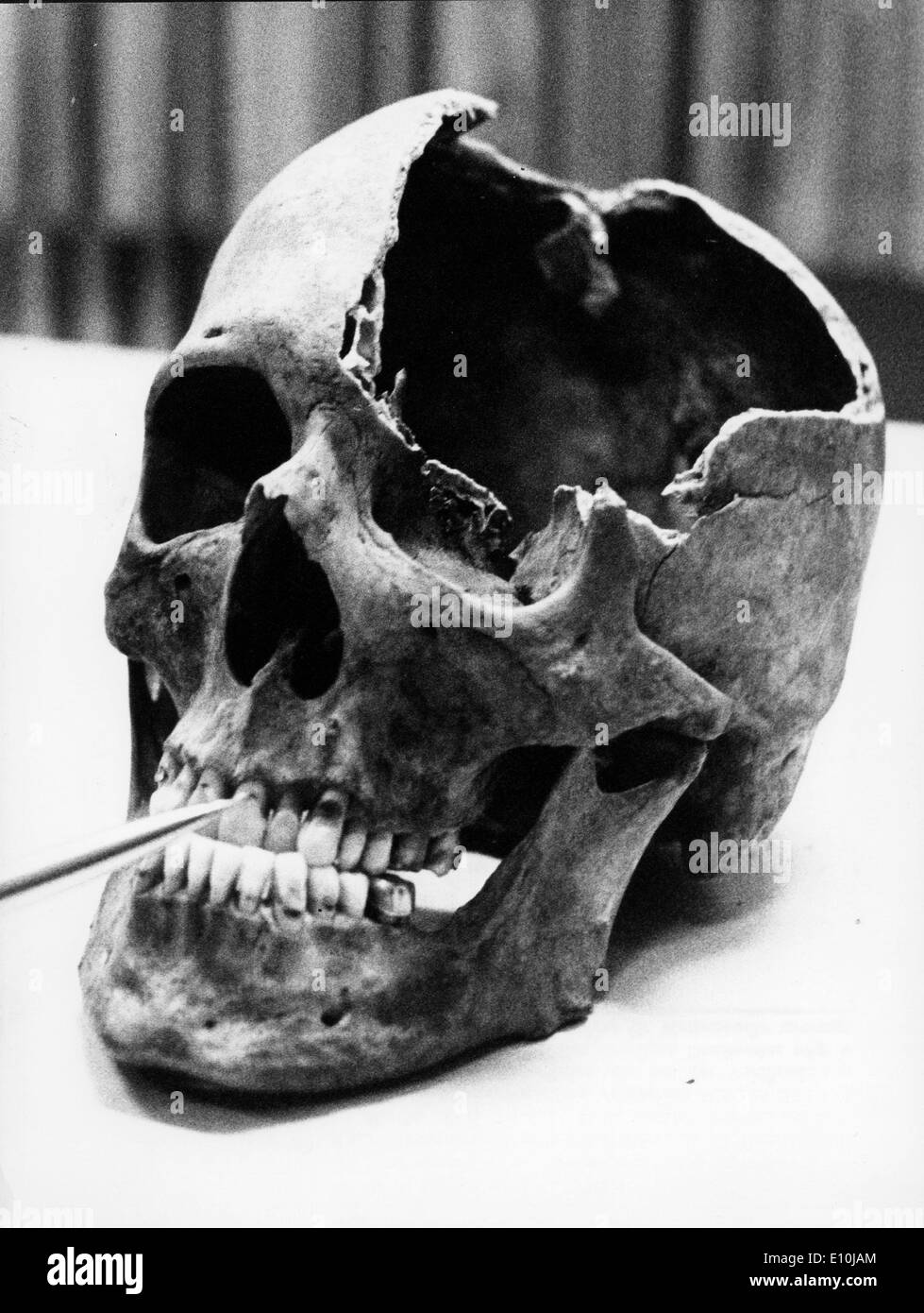 Due ossa di un teschio e la coscia, sono stati trovati negli scavi in Berlino stazione Lehrt. Foto Stock