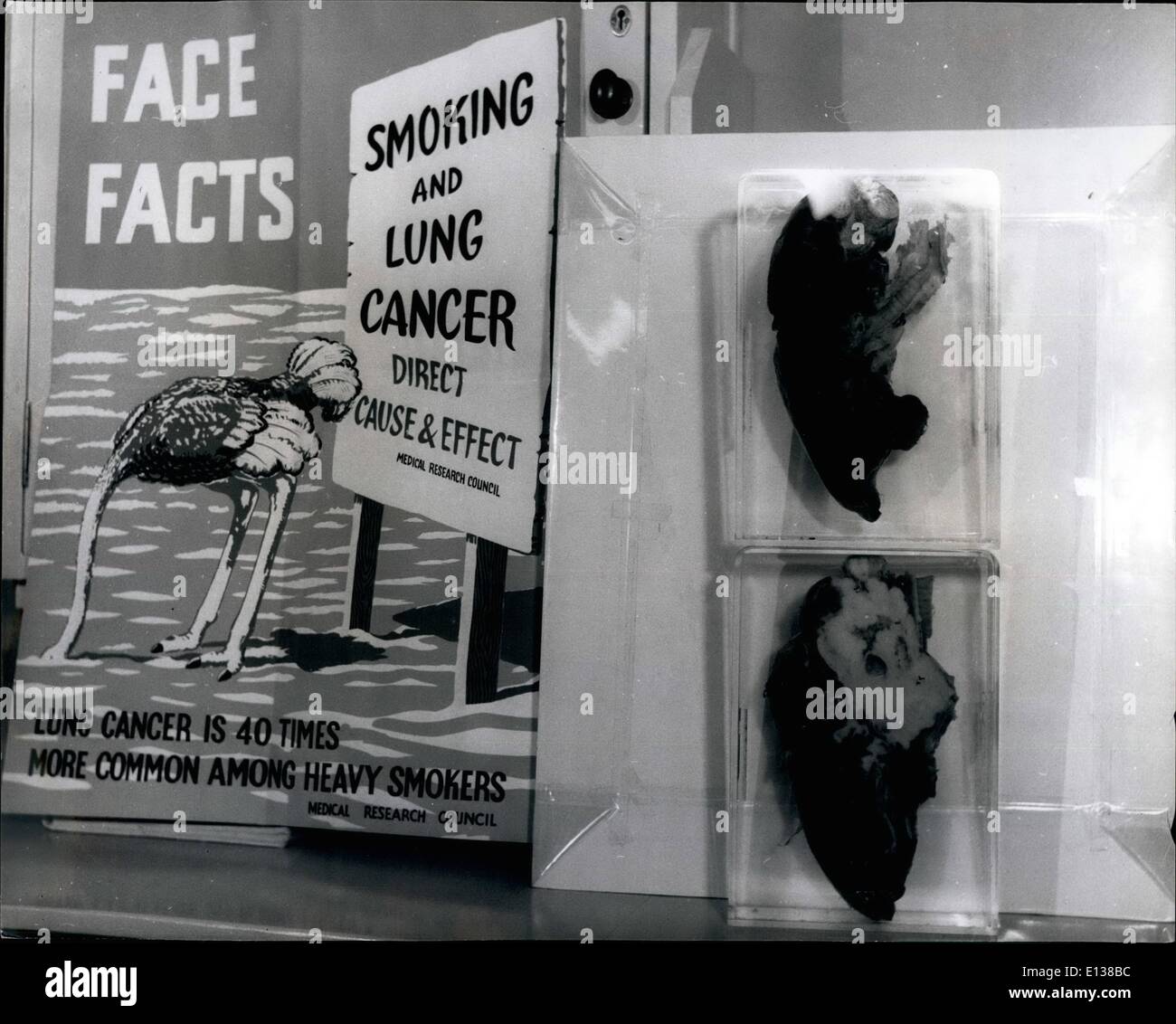 Febbraio 29, 2012 - Pioneer Anti-fumo Clinic ottiene risultati.. I risultati sono già raggiunti in quello che è probabilmente il primo anti-fumo clinica per essere aperto dal Royal College of Physicians il fumo e la salute relazione è stata pubblicata. Di Trentatré pazienti che hanno frequentato i primi quattro sessioni presso la clinica a Londra Nord ospedale, 10 hanno smesso di fumare altri hanno ridotto. Attualmente solo i pazienti di cui dal personale dell'ospedale vengano accettati Foto Stock