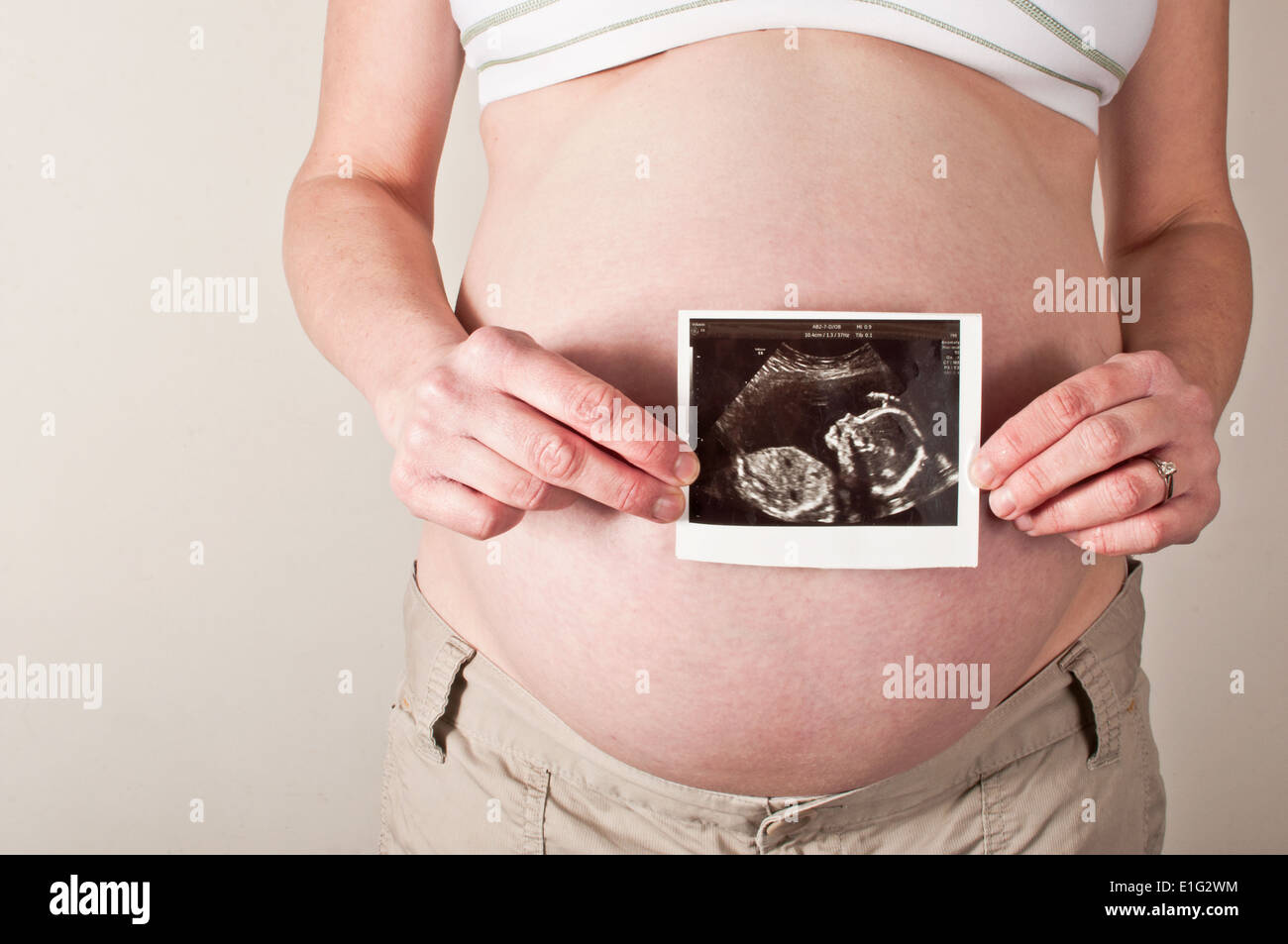 Baby scan detenute da una donna in gravidanza Foto Stock