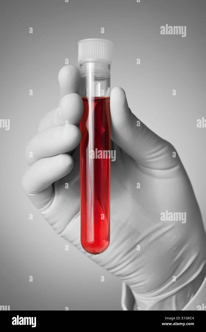 Medico tenendo una bottiglia di campione di sangue Foto Stock