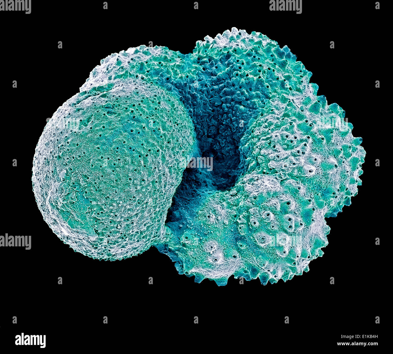 Globigerina foraminiferan Color scanning electron microfotografia (SEM) del guscio (test) di globigerina sp planctonici Foto Stock