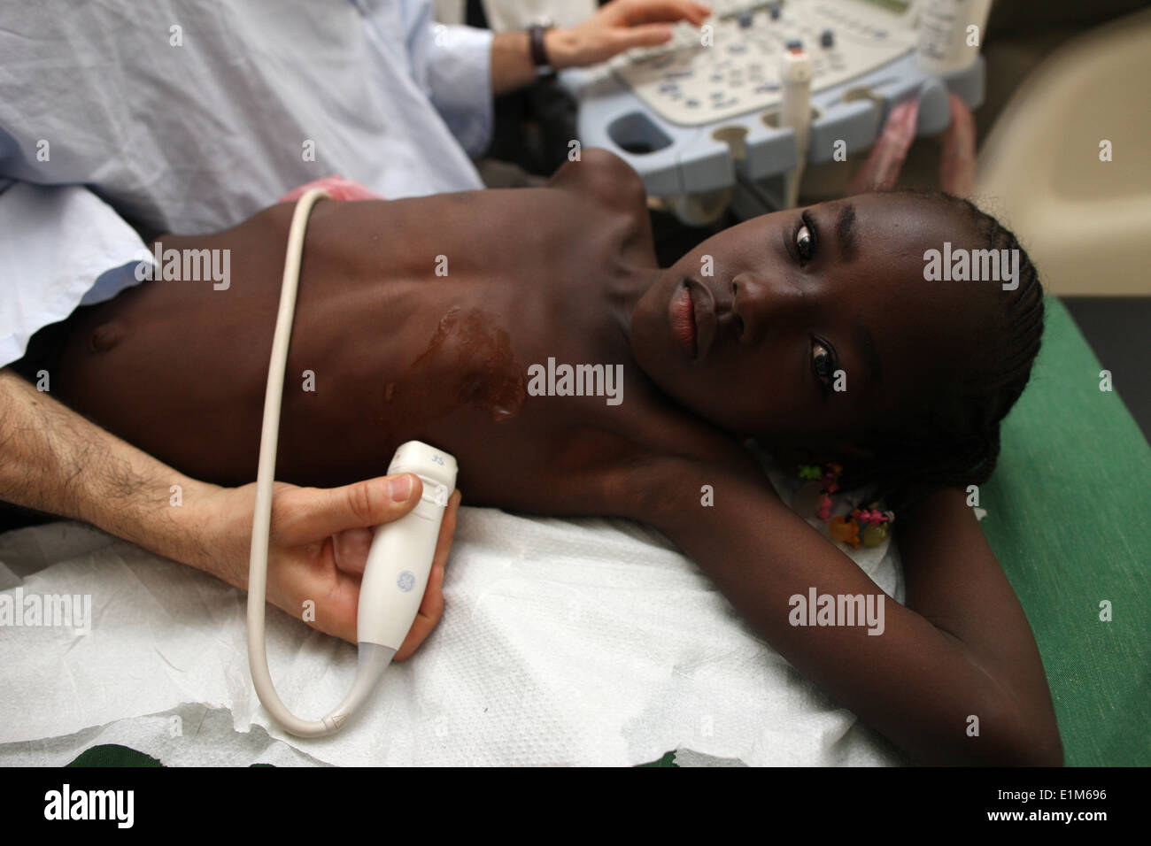 Bambino in ospedale a Bamako. Cardiologia. Ong francese la Cha"ne de l'Espoir. Foto Stock