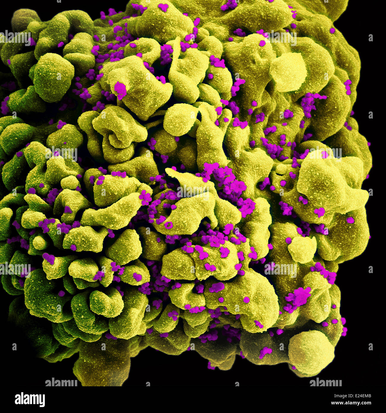 Infetti da Hiv h9 T-Cell Foto Stock