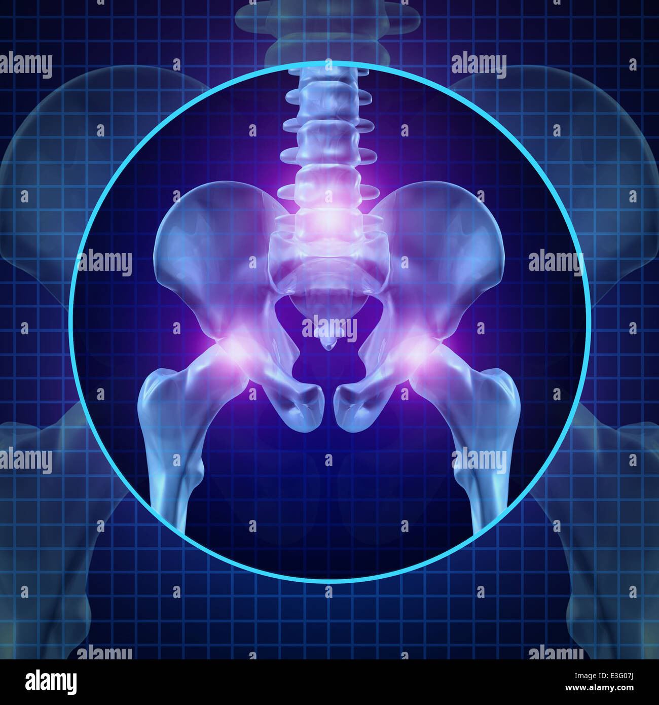 Indietro i dolori articolari e mal di schiena umana con lo scheletro che mostra il dorso dell'anca e colonna vertebrale in incandescente evidenziare come un medico di cure sanitarie concetto di chirurgia spinale e la terapia. Foto Stock
