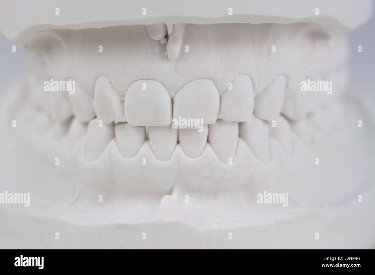 Zahnmodell Gipsabdruck Foto Stock
