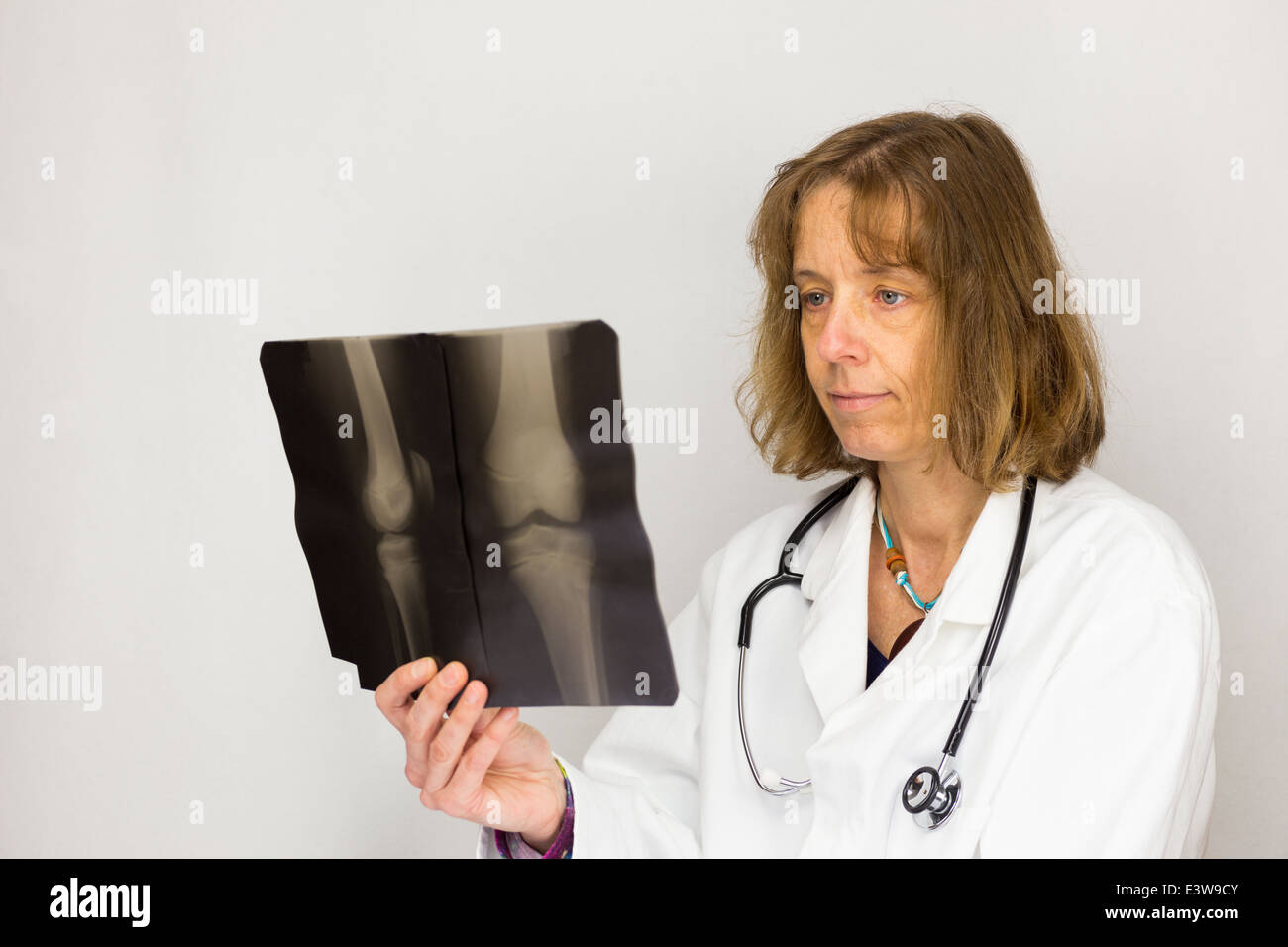 Medico donna cerchi a raggi x foto Foto Stock