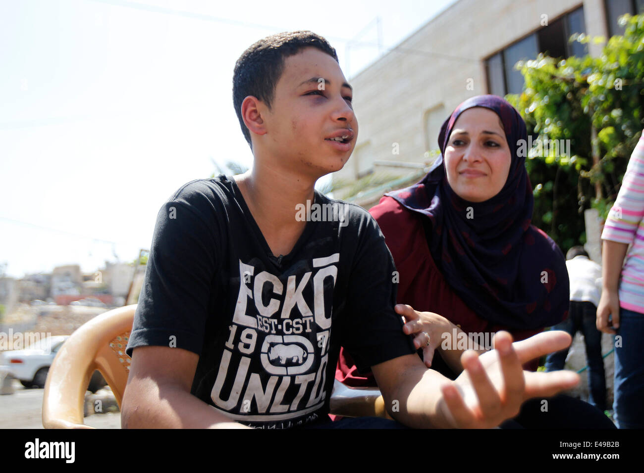 Jersualem. 6 Luglio, 2014. Tariq Khdeir (L) parla accanto a sua madre in Shuafat, un quartiere arabo del nord-est di Gerusalemme, il 6 luglio 2014. Israele il ministero della Giustizia ha lanciato un'inchiesta sulla presunta battitura di un adolescente Arab-American da gruppi paramilitari di poliziotti durante scontri a Gerusalemme, il ministero ha detto in una dichiarazione di domenica. Un video emerse su internet il giovedì, mostrando Tariq Khdeir, un 15-anno-vecchio American di discesa palestinese, duramente picchiato da due poliziotti israeliani durante scontri a Gerusalemme Est. (Xinhua/Muammar Awad) Foto Stock