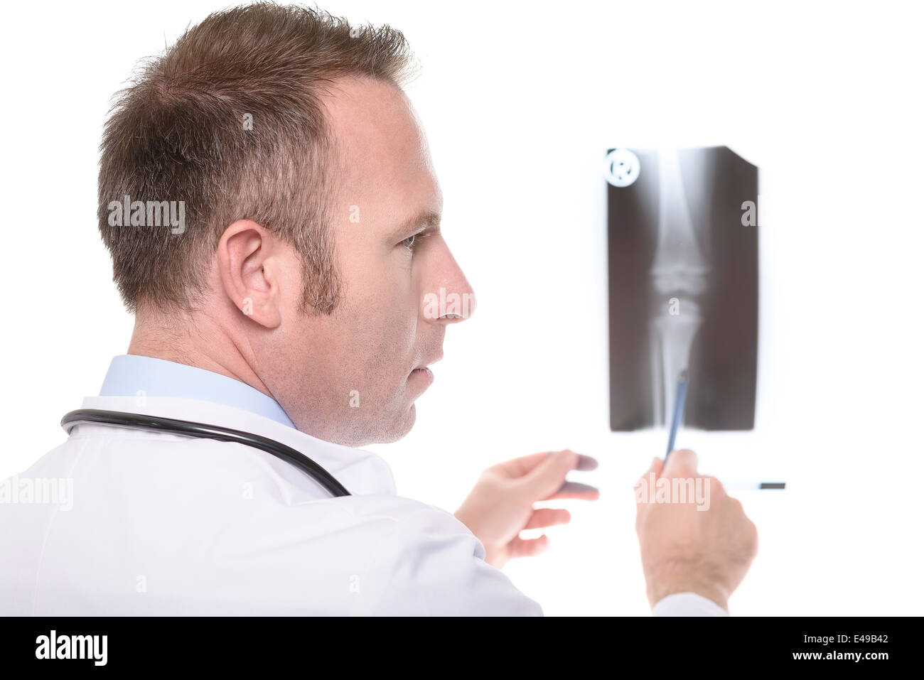 Consulenza medico a raggi x di una articolazione di ginocchio Foto Stock