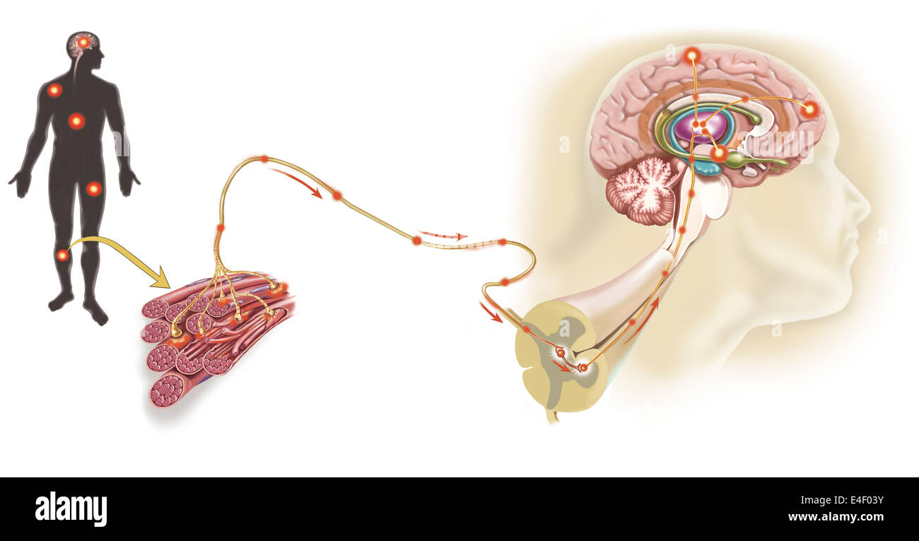 Il percorso di un messaggio del dolore attraverso il nervo sensoriale nel muscolo leso, al dolore gate nel midollo spinale di sistema limbico, corteccia frontale e Foto Stock