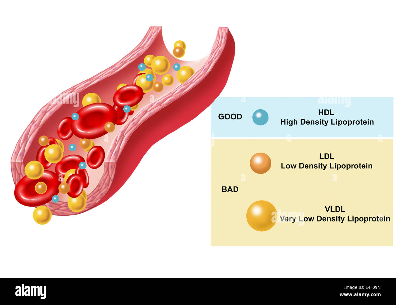 Buoni e cattivi Colesterolo trovati nel flusso sanguigno. Foto Stock