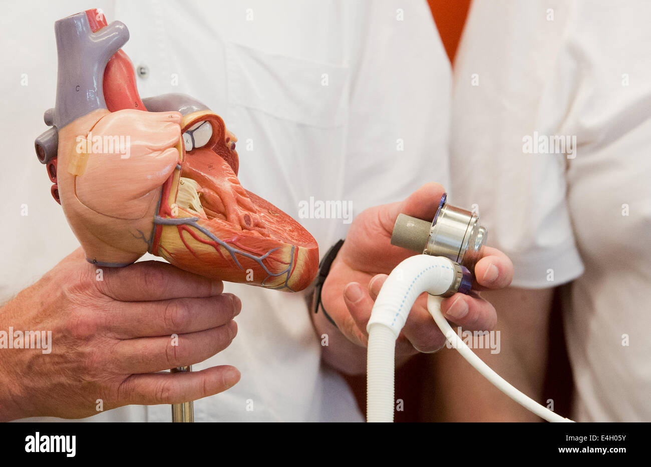Cuore chirurgo Axel Haverich contiene un cuore artificiale sistema 'Heartmate III' alla MHH - Hannover Medical School di Hannover, Germania, 11 luglio 2014. Il primo paziente in tutto il mondo per ricevere l'impianto era di 56 anno vecchio. Foto: JULIAN STRATENSCHULTE/dpa Foto Stock