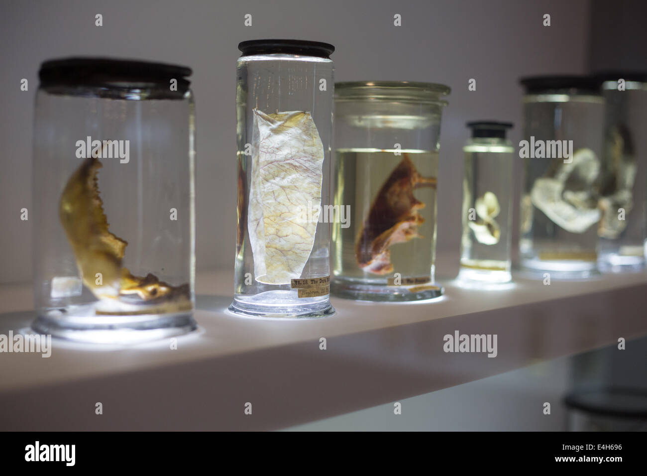 Medical esemplari nell'Hunterian Museum di Glasgow, Scozia. Foto Stock