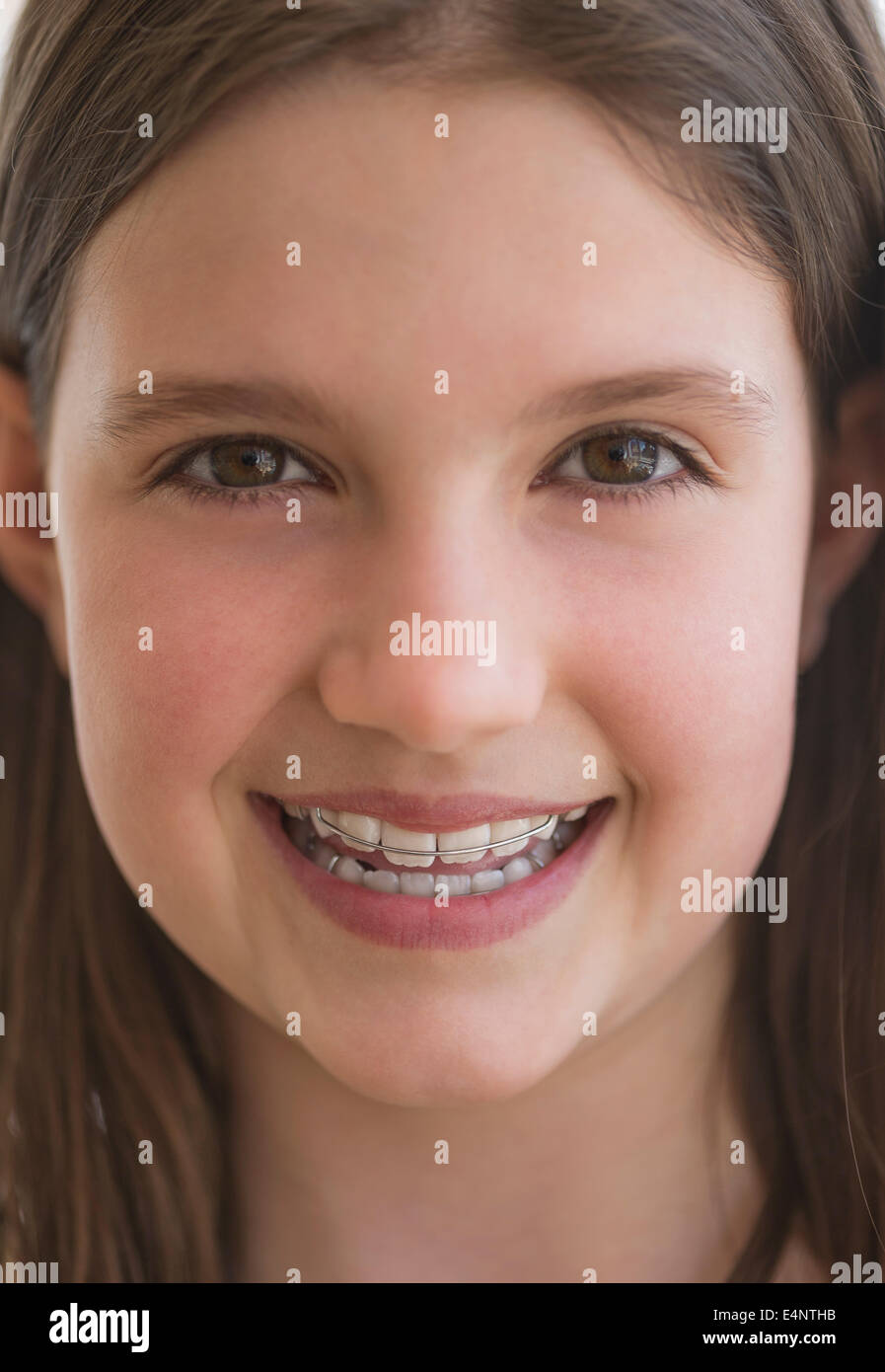 La ragazza (10-11) indossare bretelle dentali sorridente Foto Stock