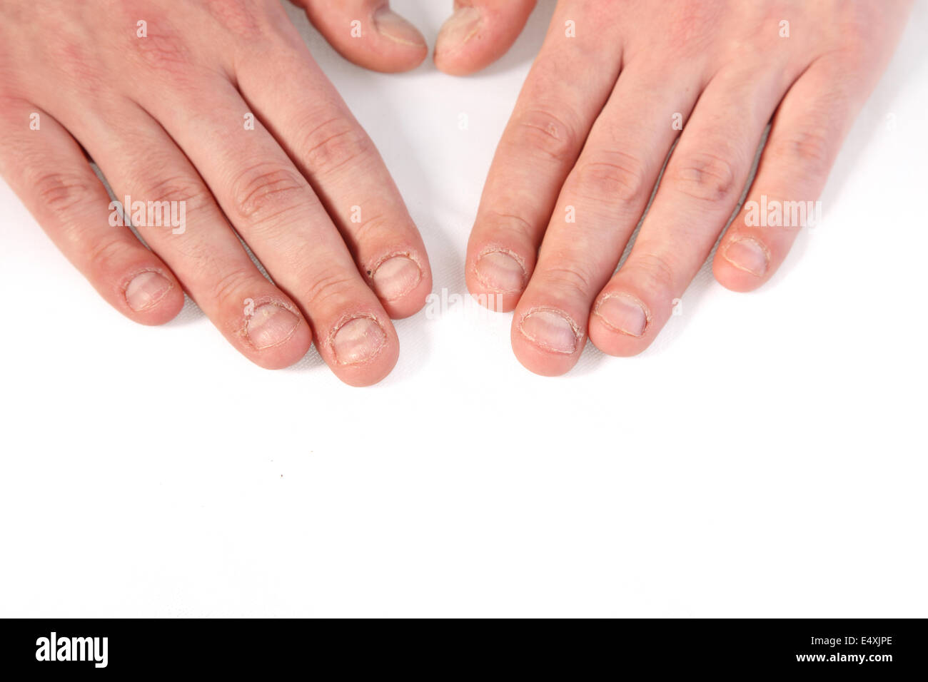 Chiodi della barretta Foto Stock