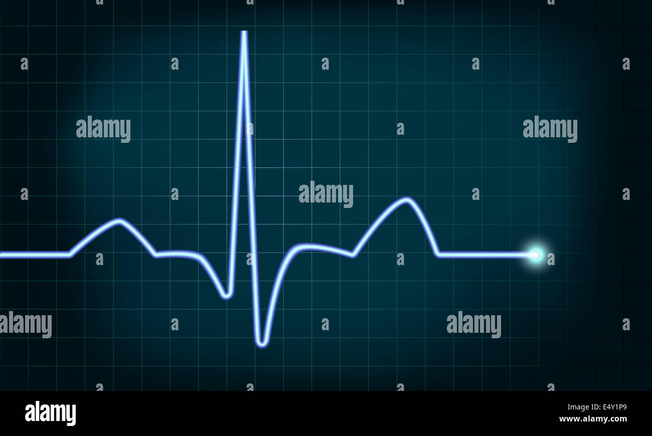 heartbeat curve Foto Stock