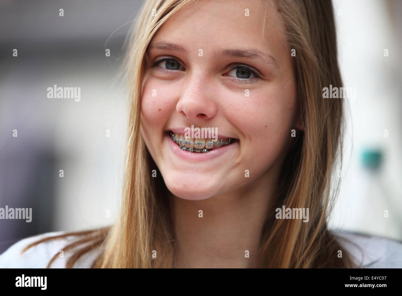 Giovane ragazza adolescente con bretelle ortodontico Foto Stock