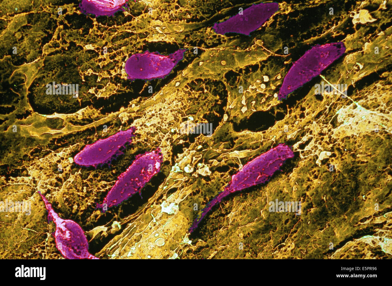I fibroblasti sulla superficie esterna dell'intestino SEM (Microscopio elettronico a scansione) Foto Stock