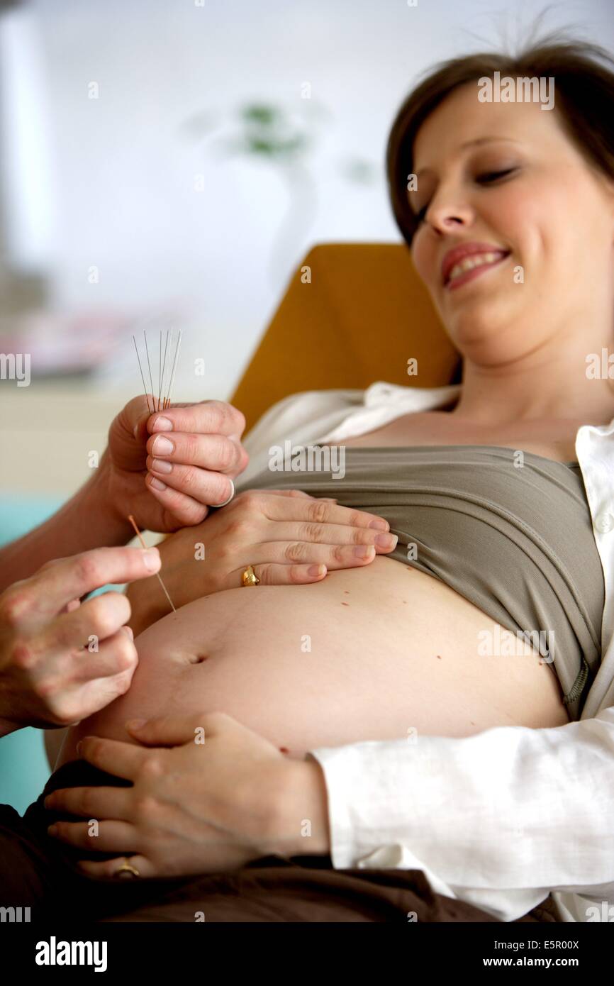 Donna incinta acupunture ricevente. Foto Stock