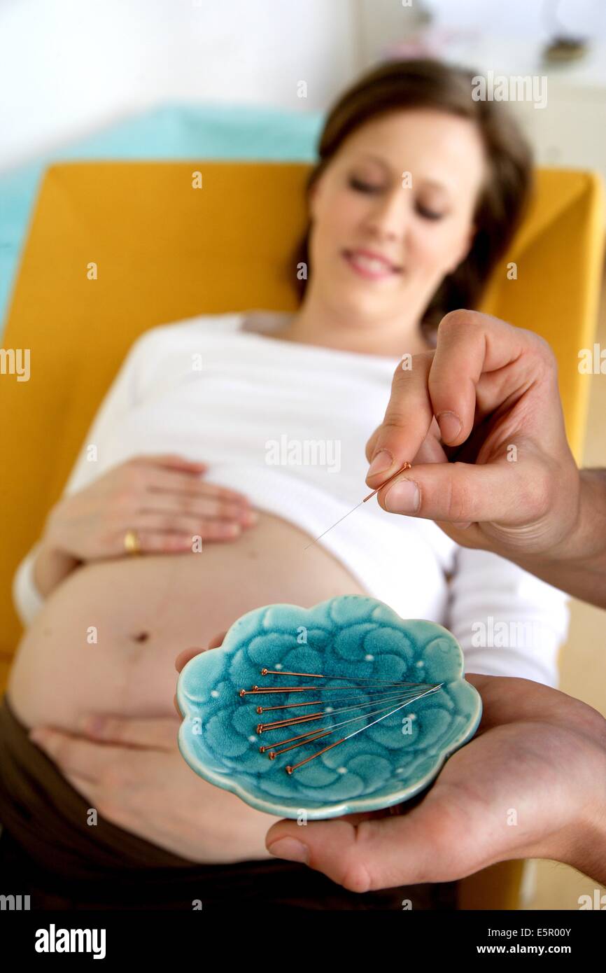 Donna incinta ricezione di agopuntura. Foto Stock