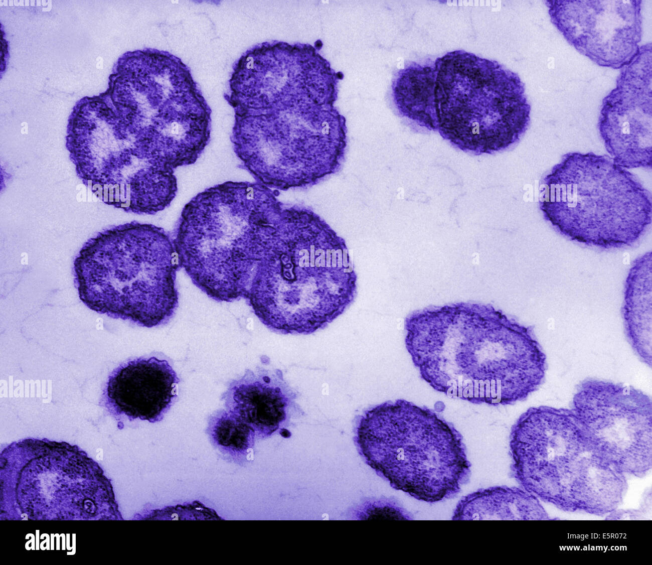 Micrografia elettronica di Neisseria gonorrhoeae, un aerobico gram-negativi, batterio responsabile per le Malattie Sessualmente Trasmesse Foto Stock