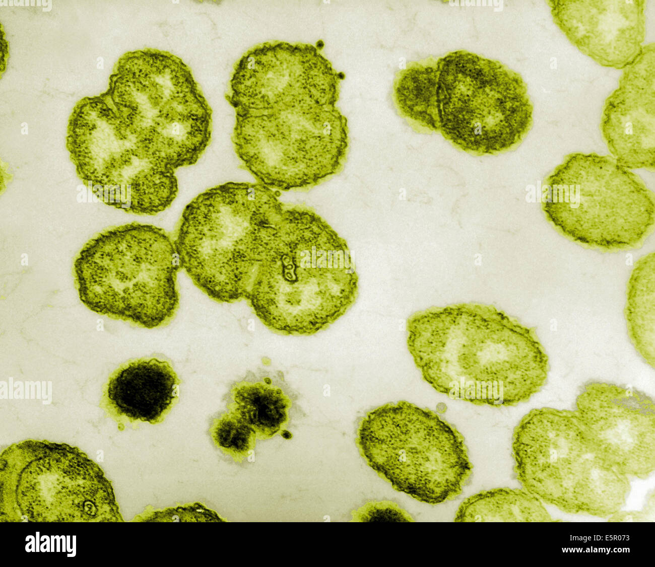 Micrografia elettronica di Neisseria gonorrhoeae, un aerobico gram-negativi, batterio responsabile per le Malattie Sessualmente Trasmesse Foto Stock