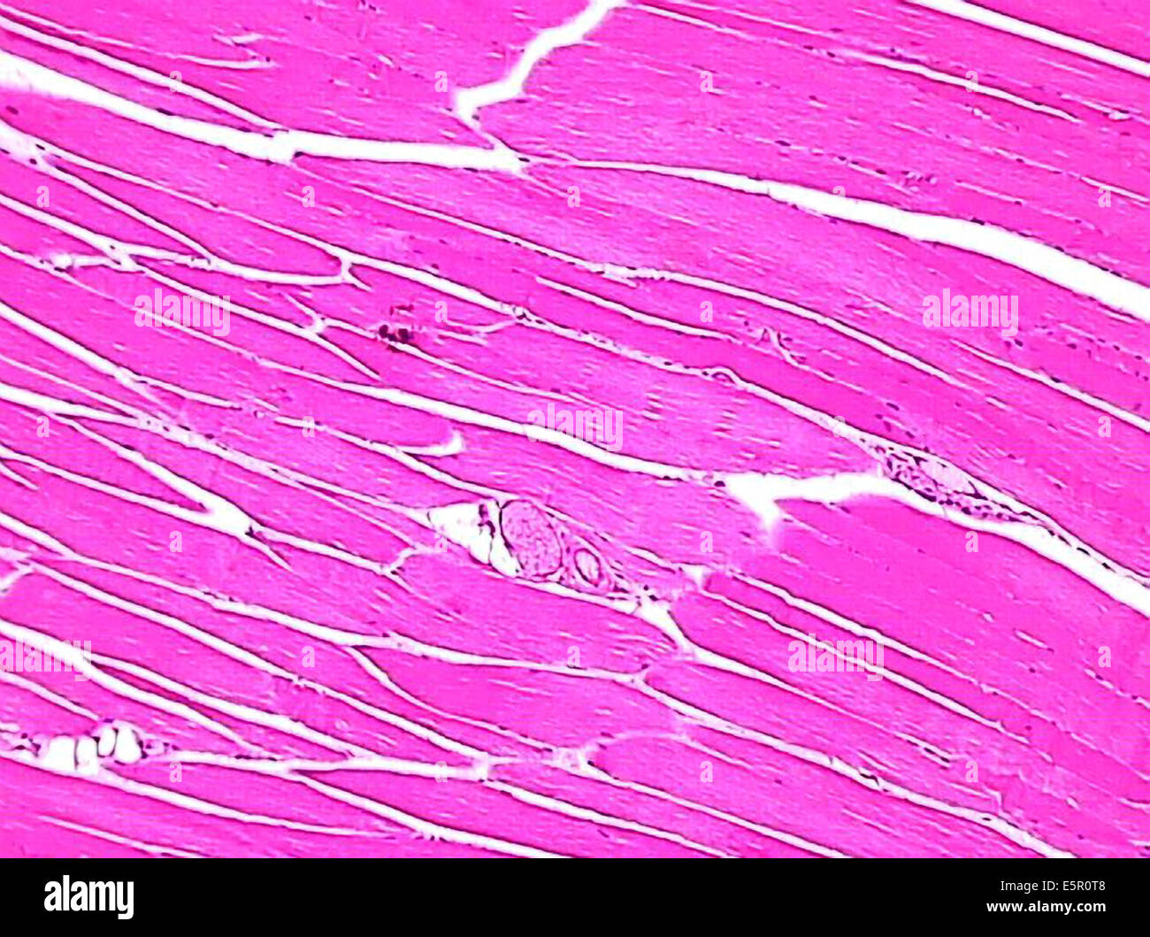 La fotomicrografia di cellule di muscolo striato. Foto Stock
