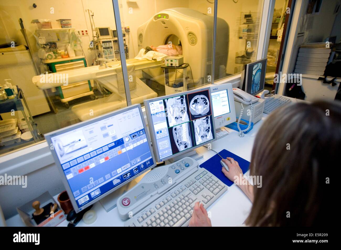 Dipartimento di imaging medico, ospedale universitario di Rennes, Francia, paziente sottoposto a una virtual colonoscop, il virtuale Foto Stock