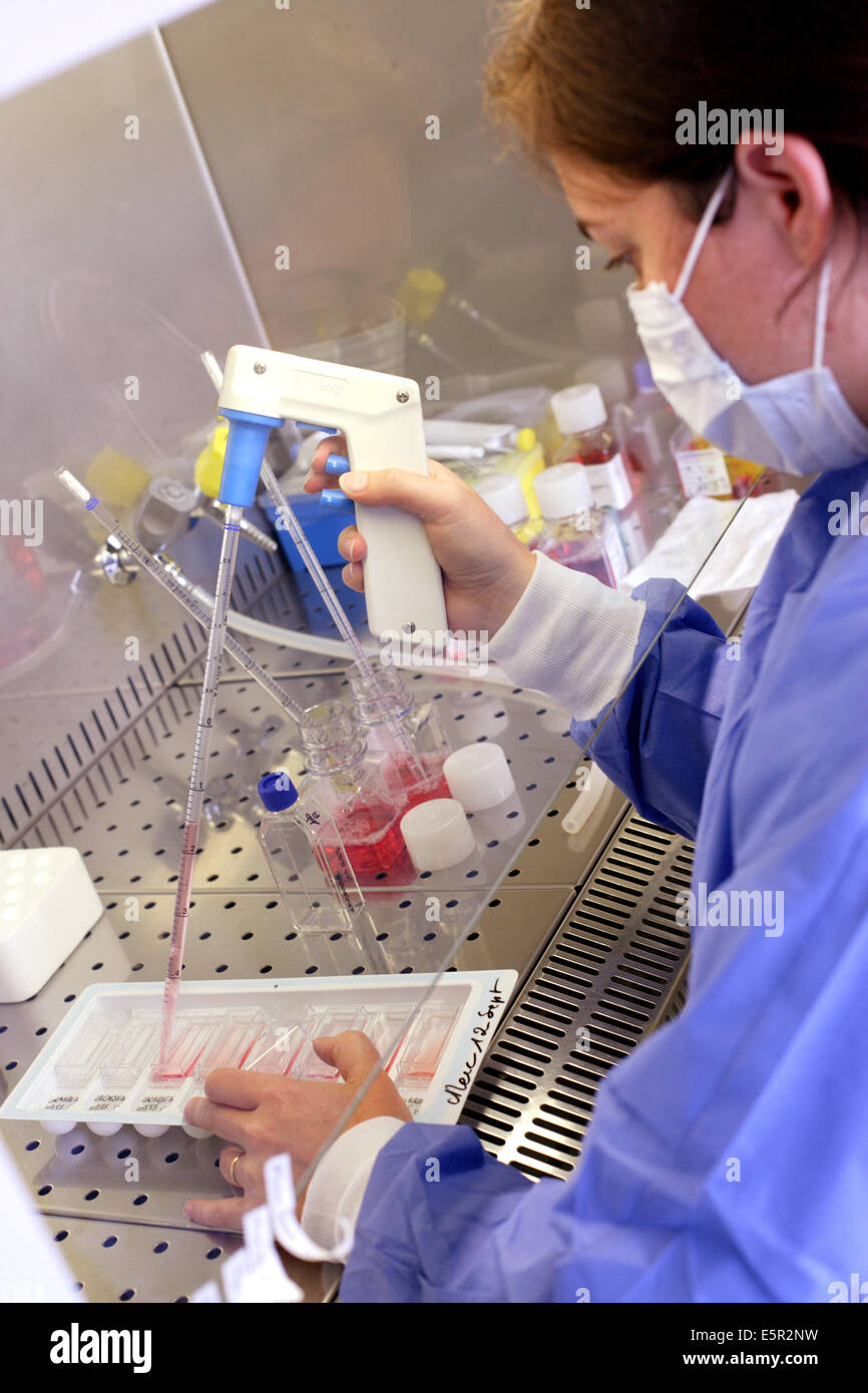 La diagnosi prenatale : cellule del liquido amniotico sono coltivati per lo screening delle anomalie chromosomic (numero di cromosomi) Foto Stock