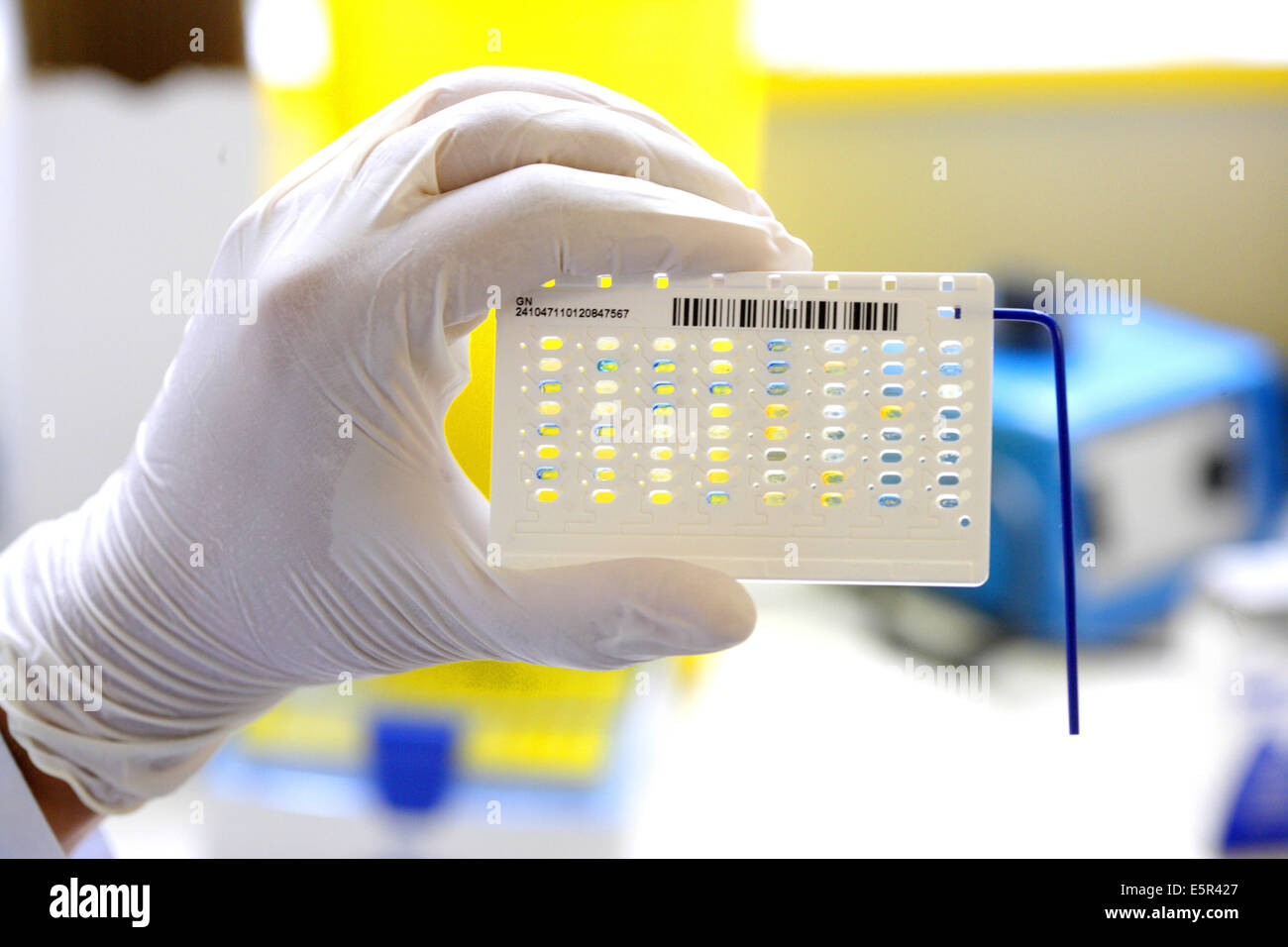 Ospedale laboratorio di analisi mediche, Lettura profilo analitico indice (API) test per identificare batteri. Foto Stock