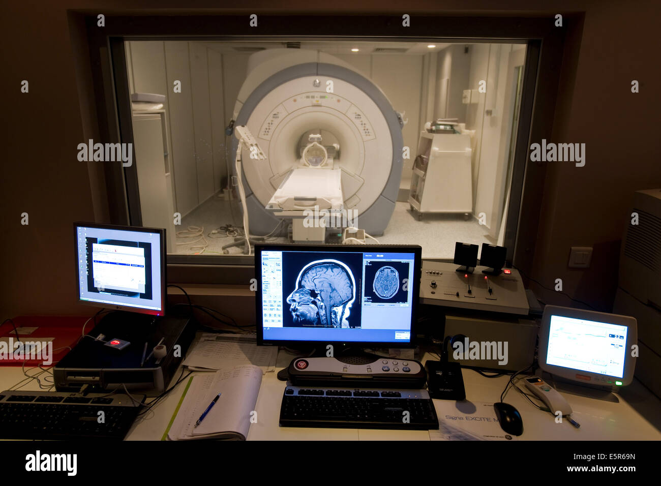 Geometria chiusa di Risonanza Magnetica (RM), unità di 3 tesla con un cervello MRI scan sulla schermata di controllo. Foto Stock