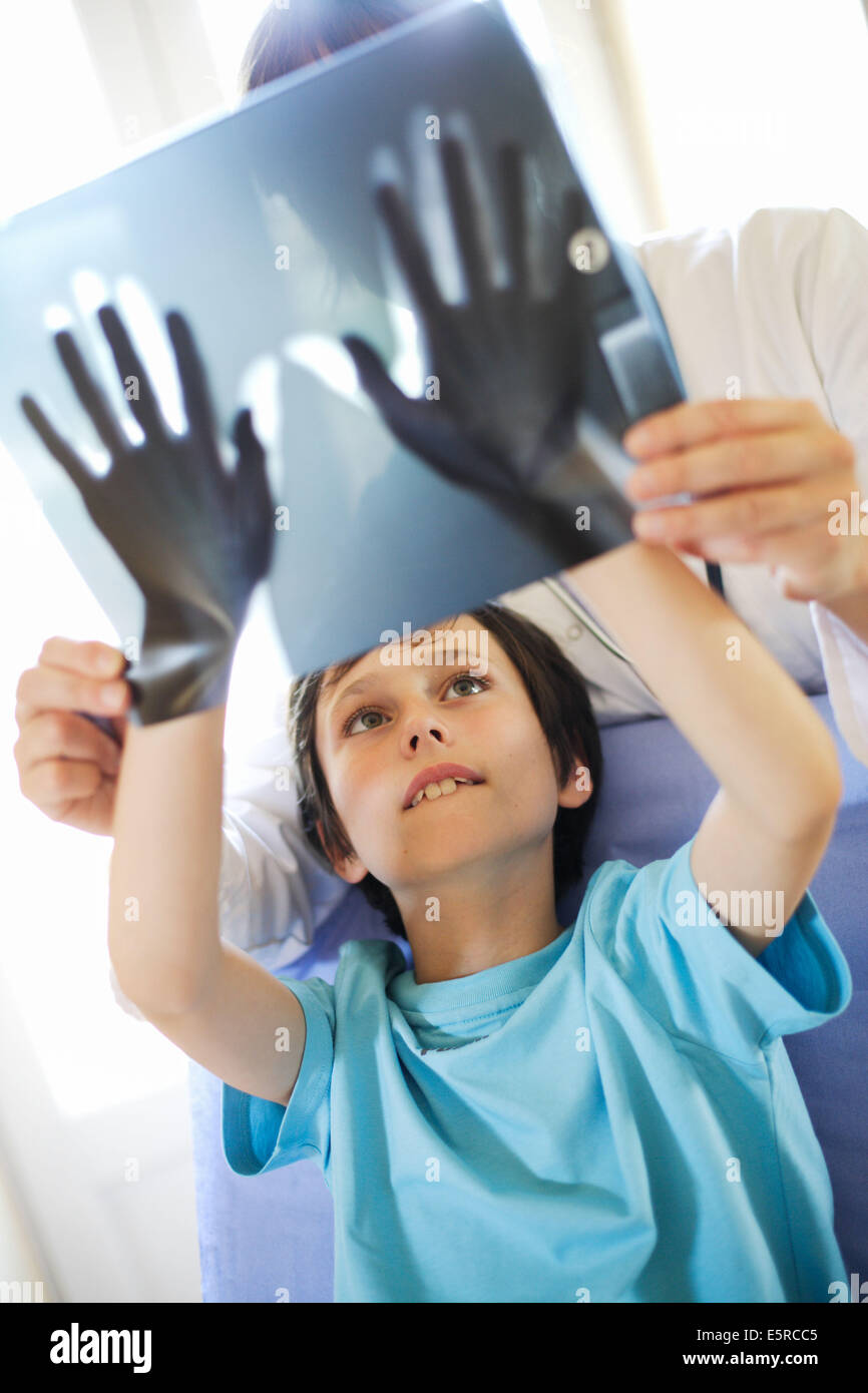 X-ray della mano di un 9 anno-vecchio ragazzo rivelando la sua età ossea. Foto Stock