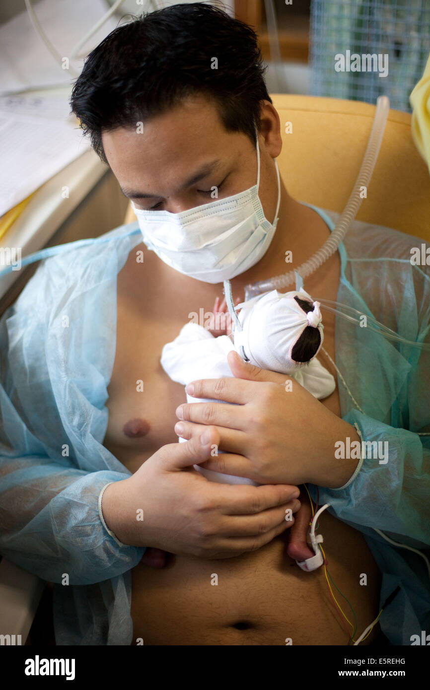 Prematuro neonato posto sotto assistenza respiratoria, dipartimento Neonatalogy, Robert Debre ospedale, Paris, Francia. Foto Stock