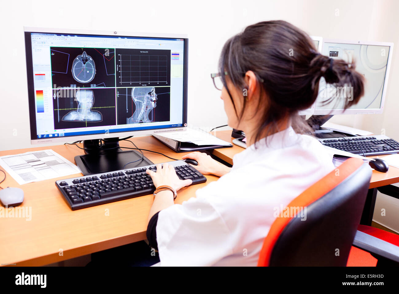 Il responsabile della dosimetria dosimetria di calcolo per la terapia di radiazione della testa e del collo il cancro, la radioterapia polo centrale di Oncologia Ospedale Foto Stock