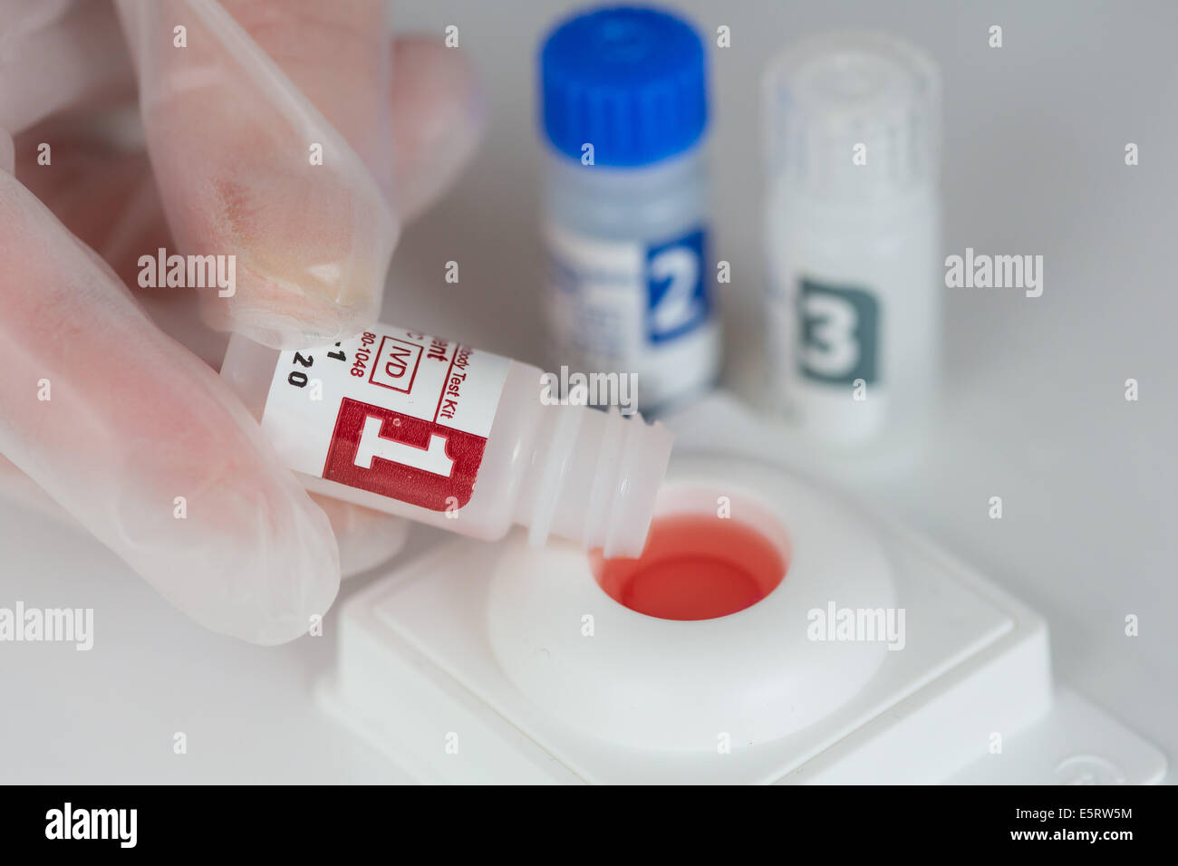 Test HIV rapido. Foto Stock