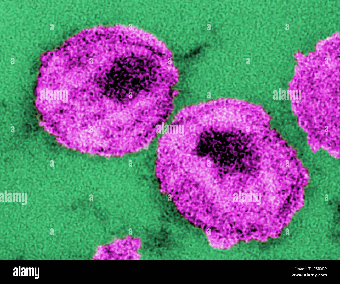 I dettagli delle due virus di immunodeficienza umana (HIV) particelle di virus, oppure virioni, microscopio elettronico a trasmissione (TEM). Foto Stock