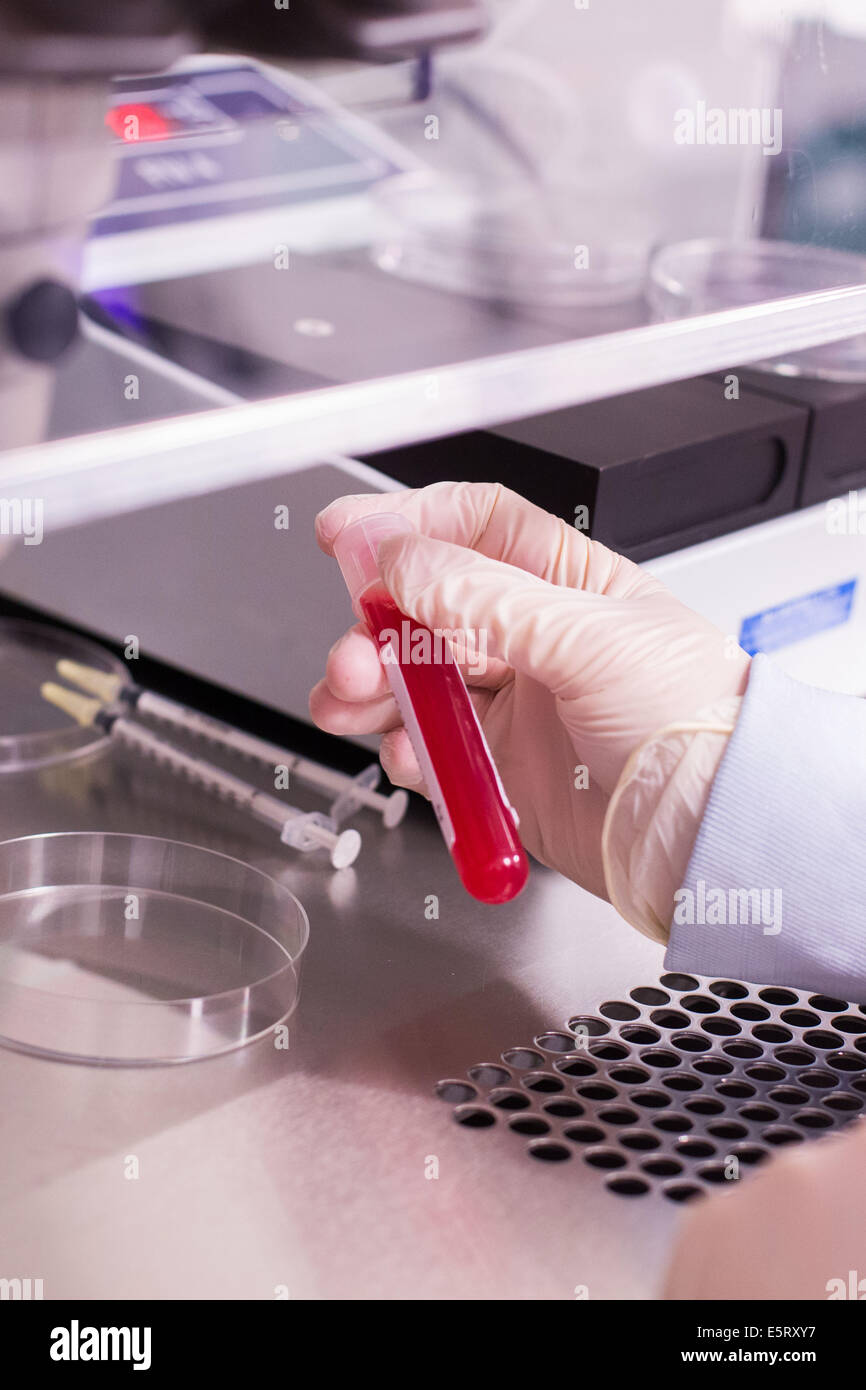 Raccolta di oocita : tubo di fluido follicolare contenenti oociti, la Procreazione Medicalmente Assistita laboratorio, (CECOS), Foto Stock