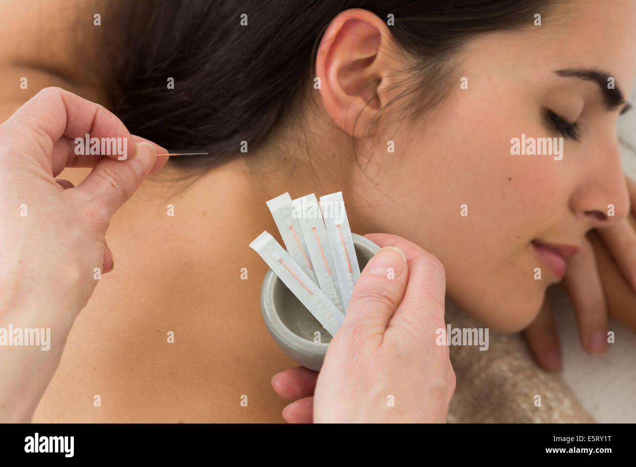 Donna acupunture ricevimento sul retro. Foto Stock