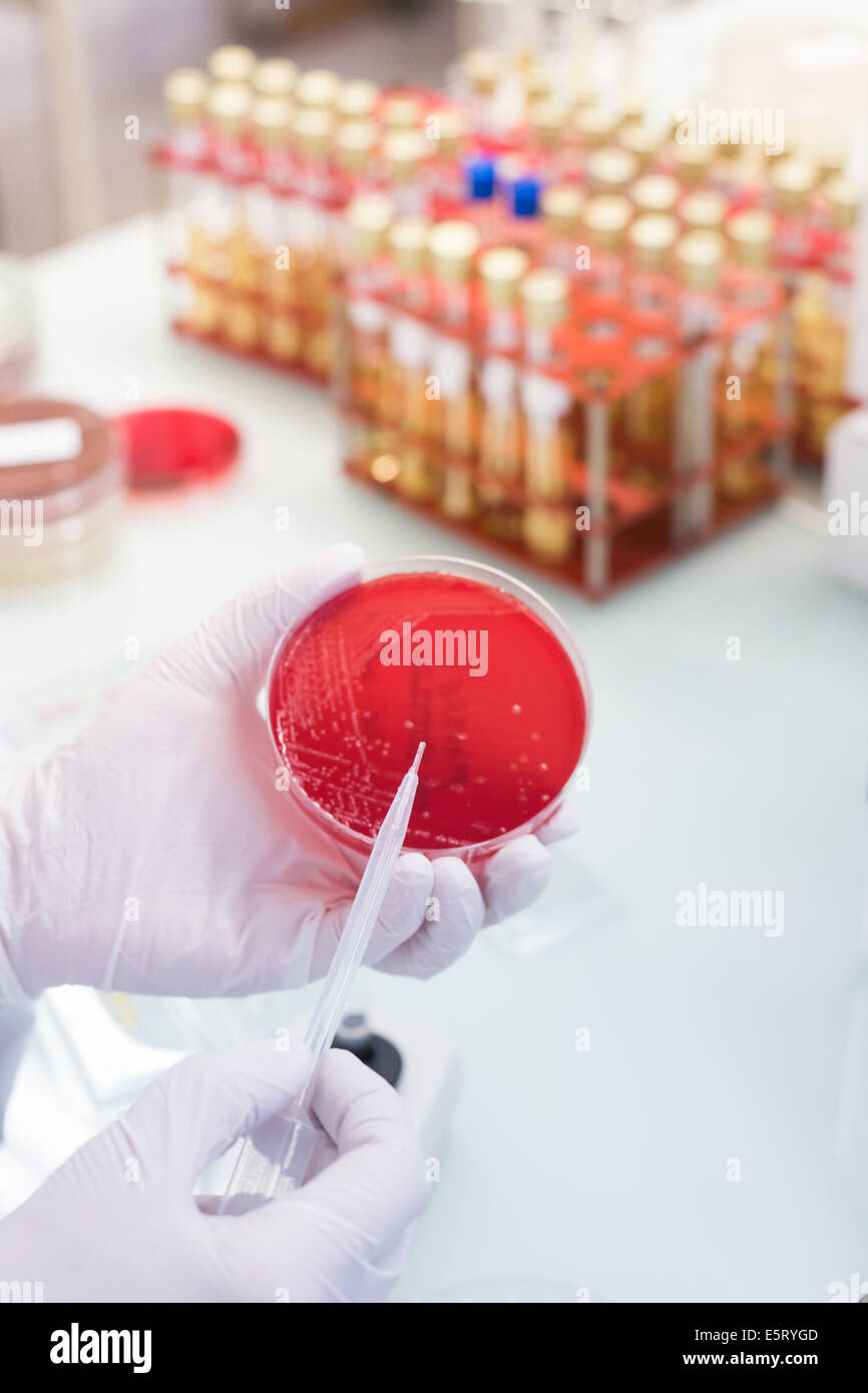 Coltura batterica in una capsula di petri, laboratorio di analisi mediche Foto Stock