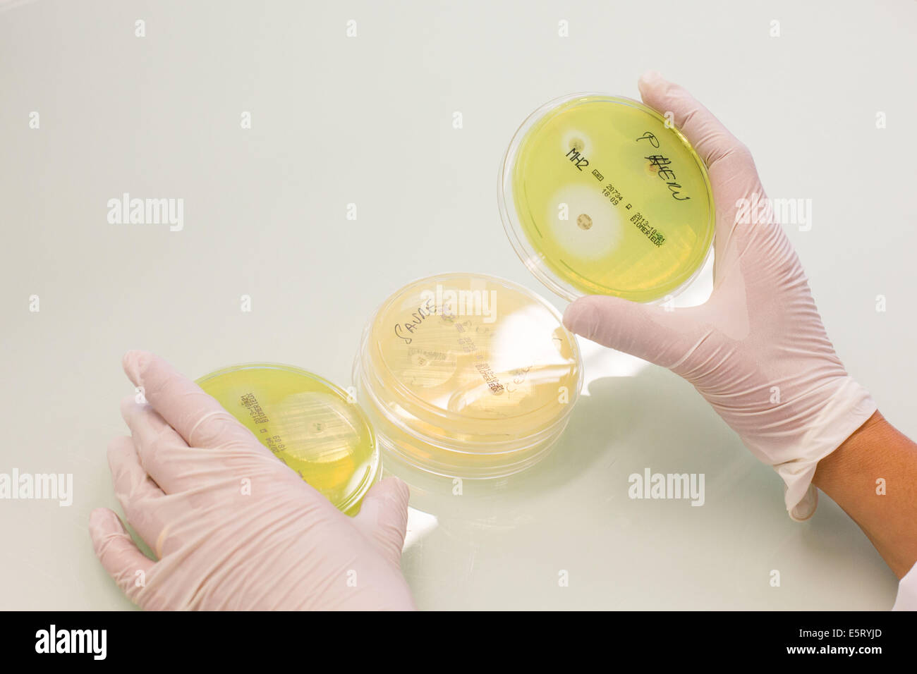 Test di antibiotico in capsule di petri in un laboratorio di analisi mediche Foto Stock