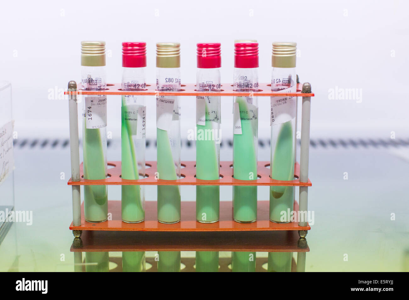 La cultura del fungo in tubi di prova in un laboratorio di analisi mediche Foto Stock