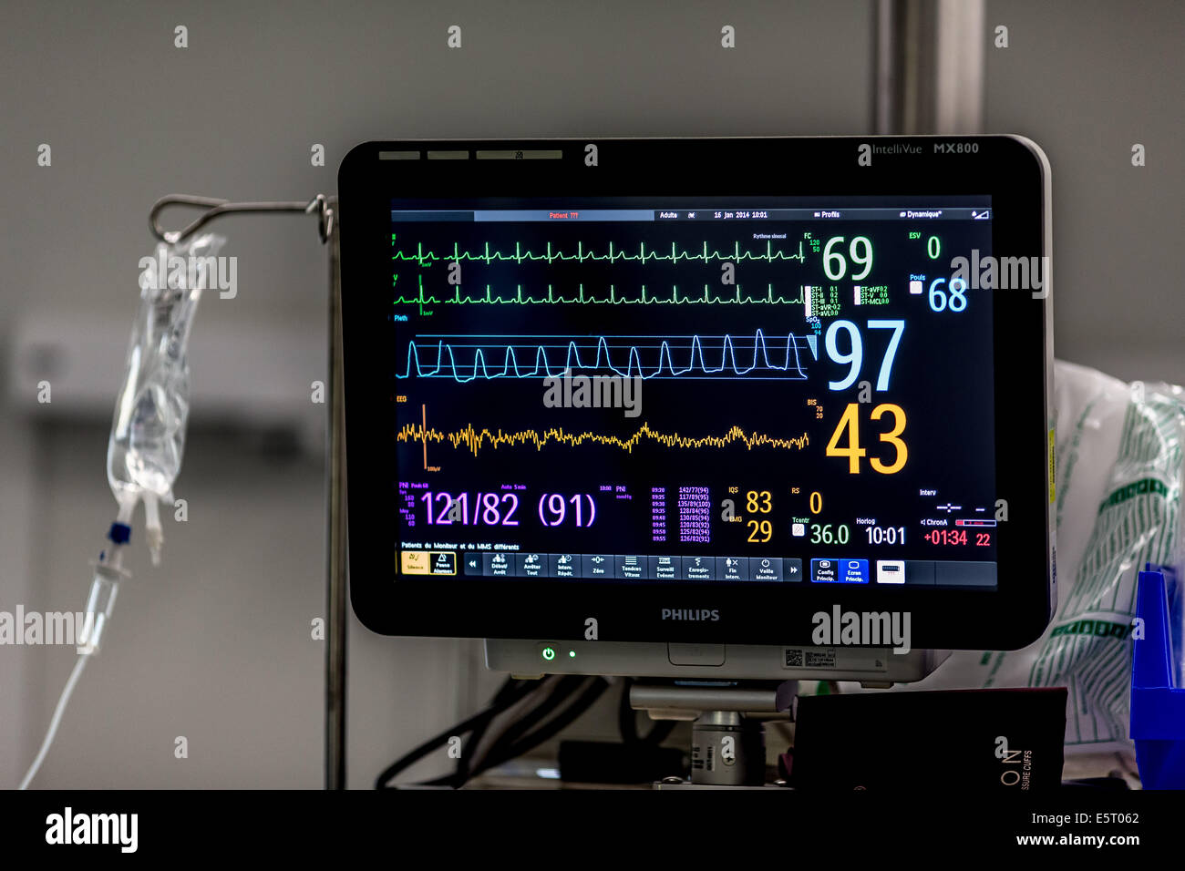 Monitoraggio durante la chirurgia, i segni vitali (frequenza cardiaca, della temperatura e della pressione del sangue, l'ossigenazione del sangue del paziente sono Foto Stock