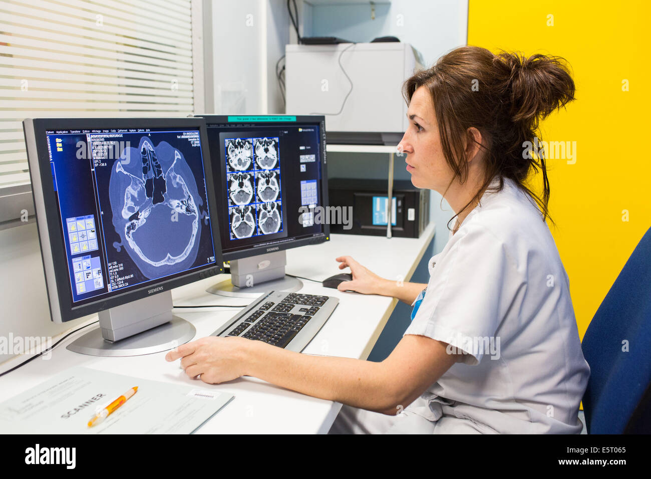 Brain CT scan, Angoulême ospedale, Francia . Foto Stock