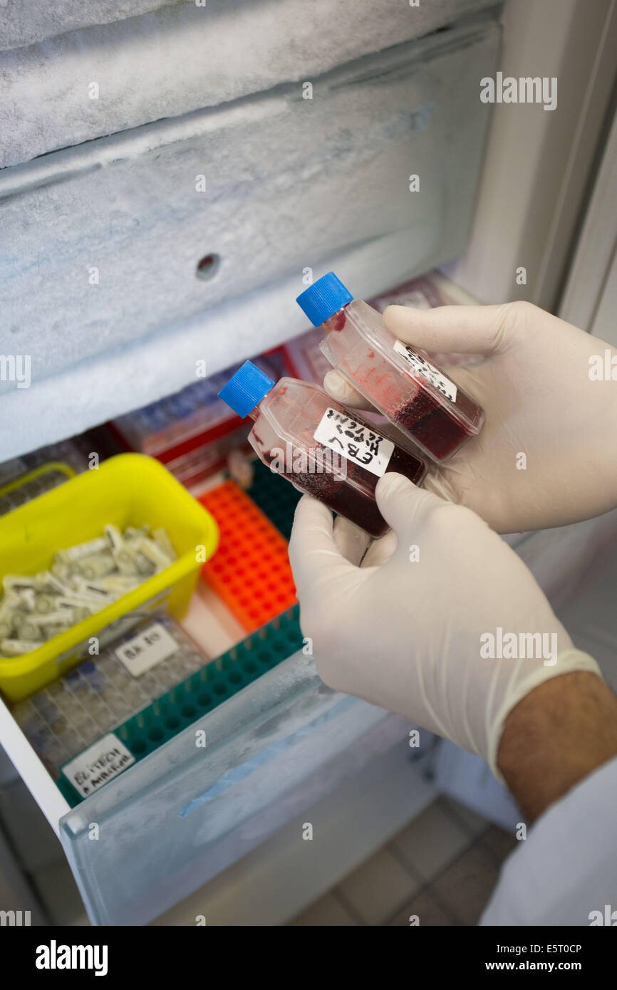 Crioconservati i campioni di sangue EBV virus epatite status, Centro de riferimento National des Hepatites virales, Henri Mondor Foto Stock