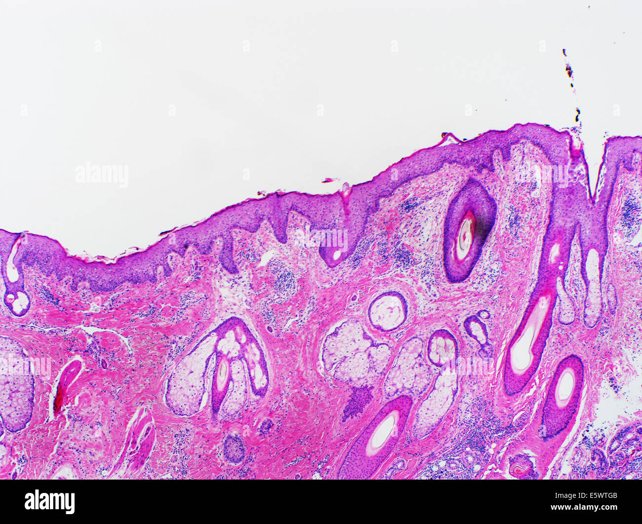 H&E macchia, la microscopia ottica, pelle normale del cuoio capelluto Foto Stock