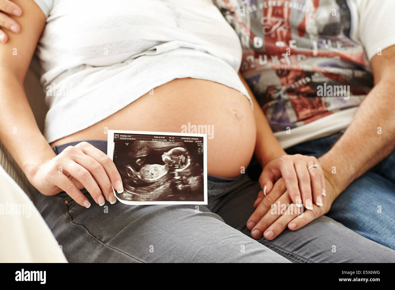 Donna incinta azienda foto di baby scan Foto Stock