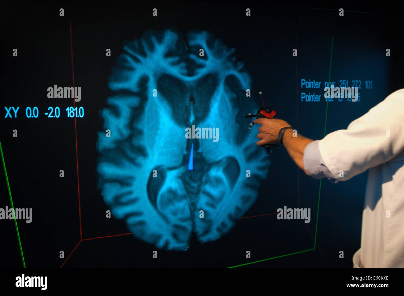 Medico specialista puntando verso la zona dove si trova la ghiandola pineale è situato su un virtuale immagine 3D di un cervello Foto Stock