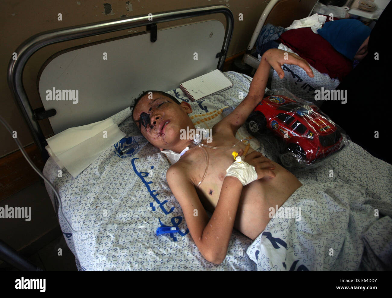 La striscia di Gaza. 11 Ago, 2014. Bambino palestinese Mohamed Badran si appoggia a al-Shifa Hospital di Gaza City il 11 agosto 2014. Badran, un 8-anno-vecchio ragazzo di Gaza, si è infortunato e ha perso uno dei suoi occhi in un israeliano airstrike sulla sua casa di famiglia. © Yasser Qudih/Xinhua/Alamy Live News Foto Stock