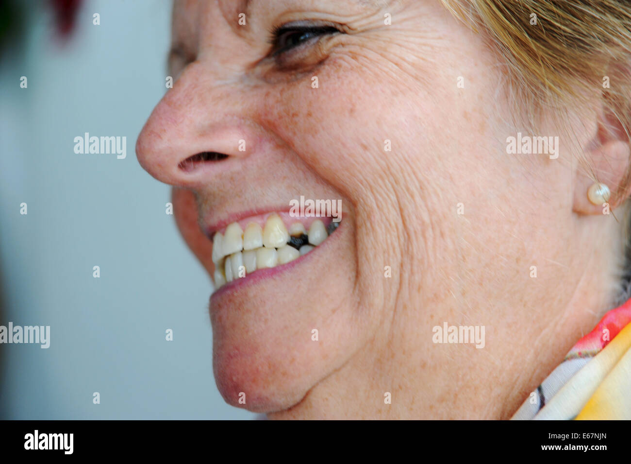 Donna sorridente che mostra la rottura di un dente anteriore Foto Stock