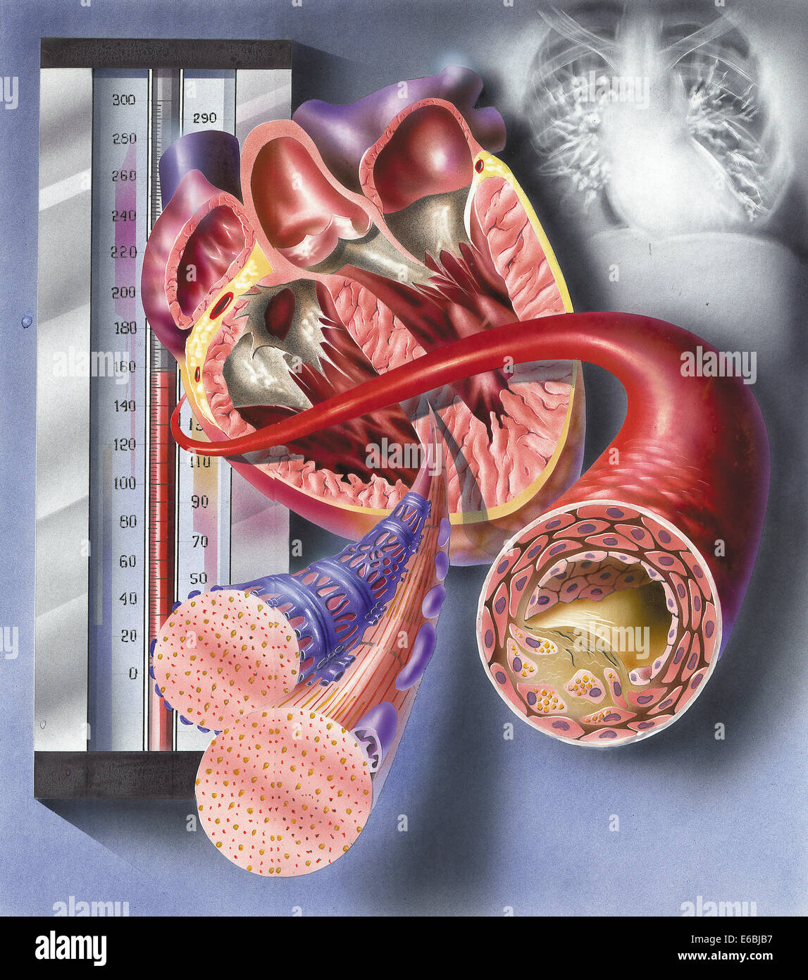 Vista interna del cuore con il dettaglio delle cellule muscolari e arteria aterosclerotica. I raggi x al torace in background. Foto Stock